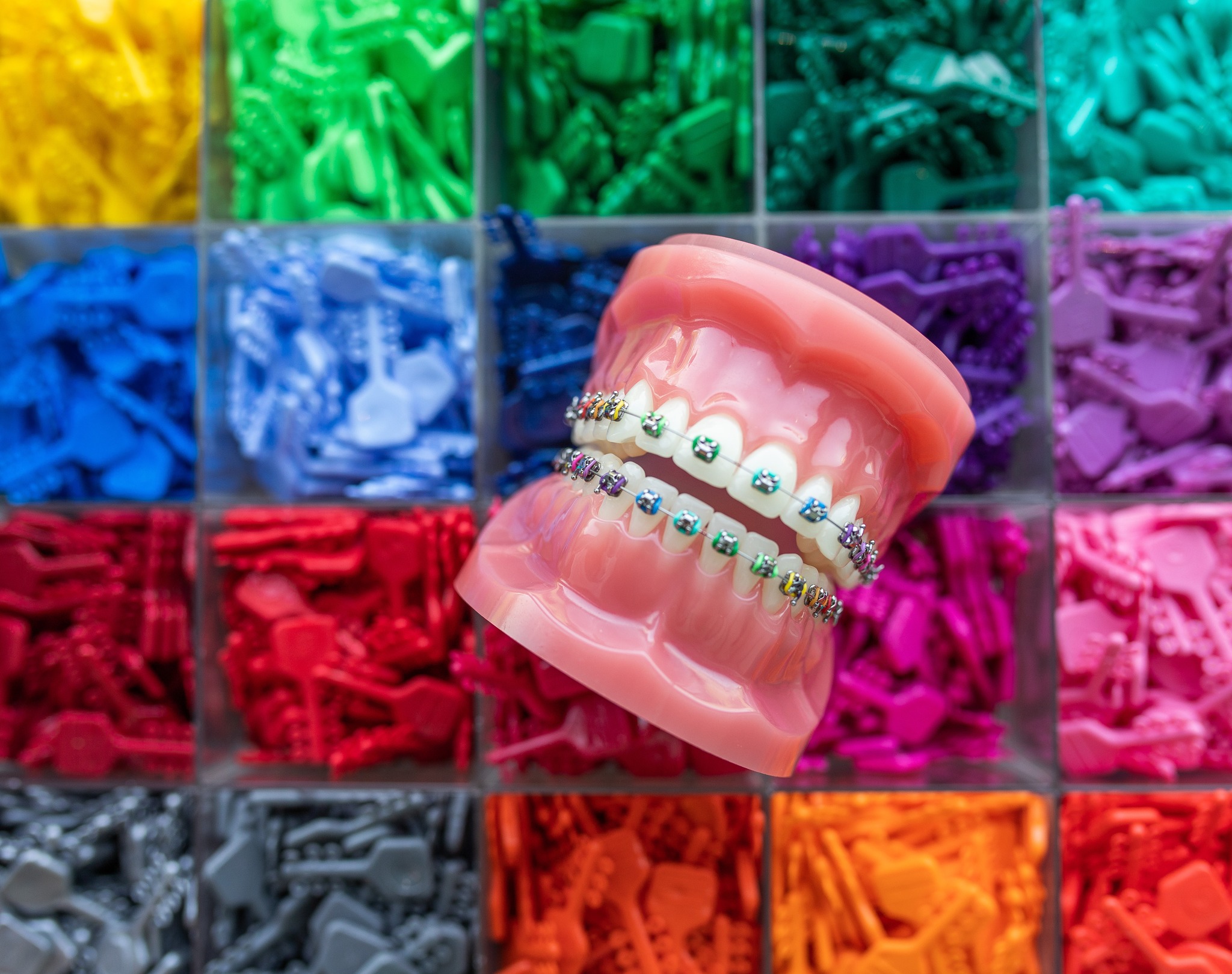 Orthodontic treatment option