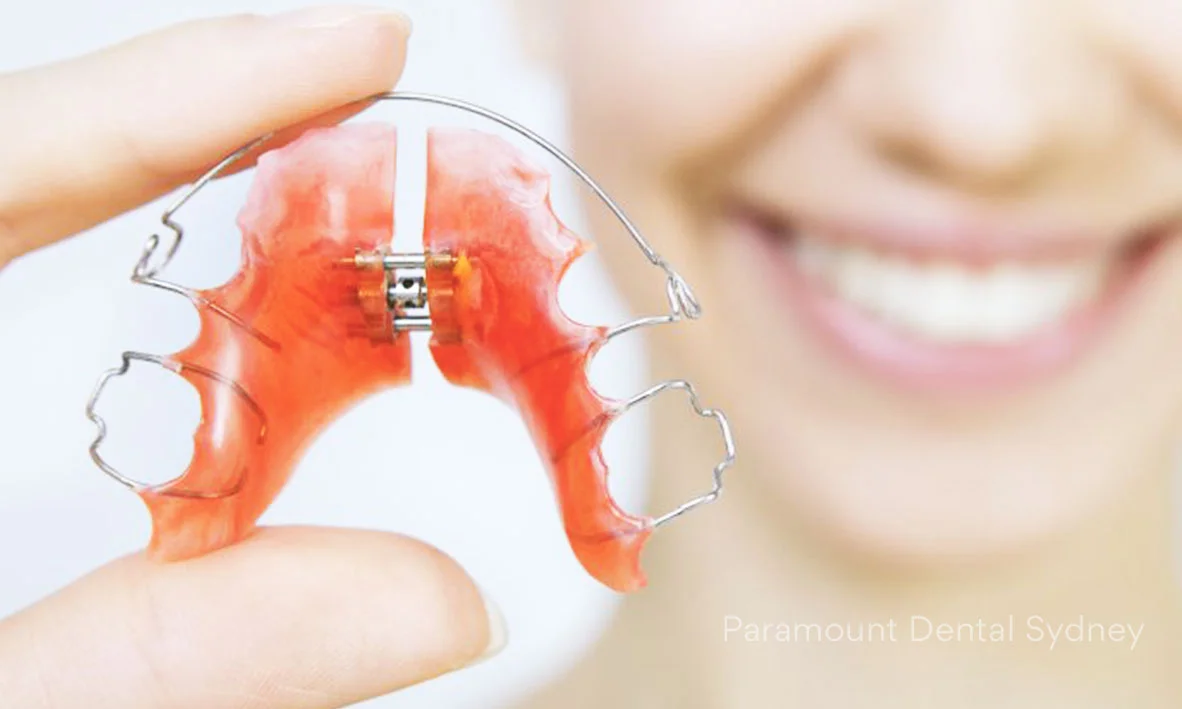 Orthodontic appliances